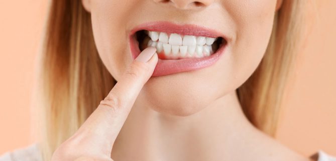 آبسه دندان چیست؟ و راه های درمان آن چگونه است؟