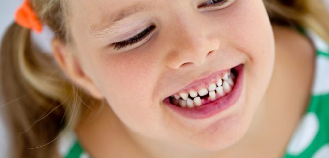 اثرات دندان از دست‌رفته چیست؟