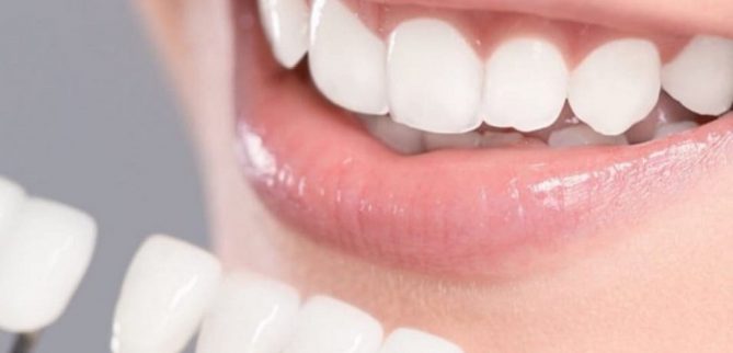 تاج گذاشتن روی دندان چیست؟