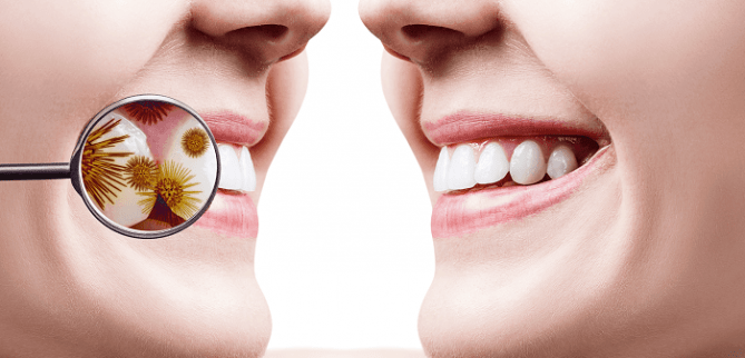 روش های درمان عفونت دندان